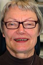 Kirsten før foto