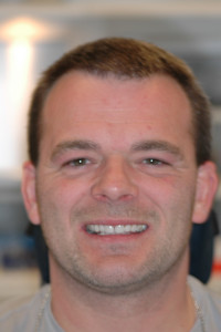 Benny fik lavet flotte porcelæns facader. 