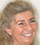 Hanne fik opfyldt drømmen om et smukkere smil med stabilitet