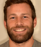 Mads fik styrket og forskønnet sine tænder med plast