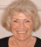 Anne fik sit flotte smil tilbage efter paradentose